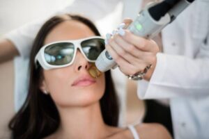 laser facial rejuvenation