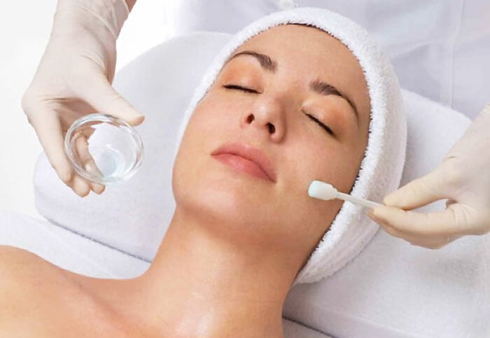 a woman treated with chemical peels in toronto