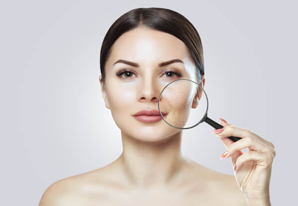 Enlarged pores texture treatment