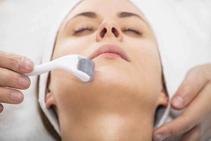 woman on her microneedling treatment in toronto