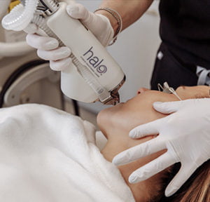 Patient receiving fractional laser resurfacing at Kingsway Dermatology in Toronto